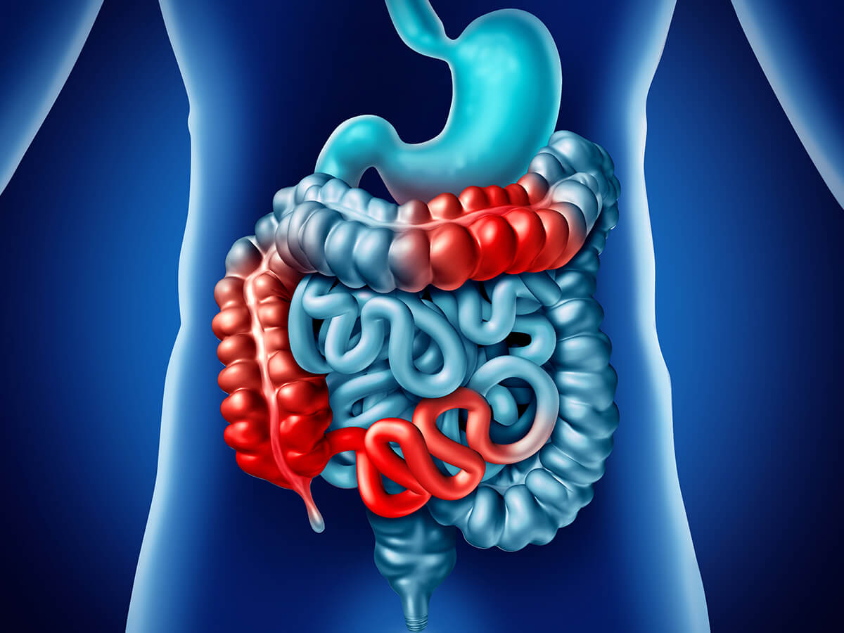 https://www.agmg.com/content/3-digestive-health/digestive-health-crohns-disease-colitis.jpg
